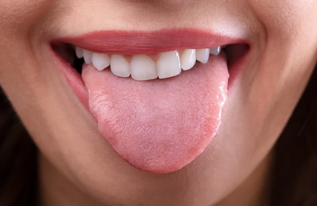 Tharja e Gojës – Si ta Zgjidhni me Kurat e Duhura Natyrale