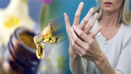 Keto jane 4 ushqimet që nuk duhet të hani nëse vuani nga artriti